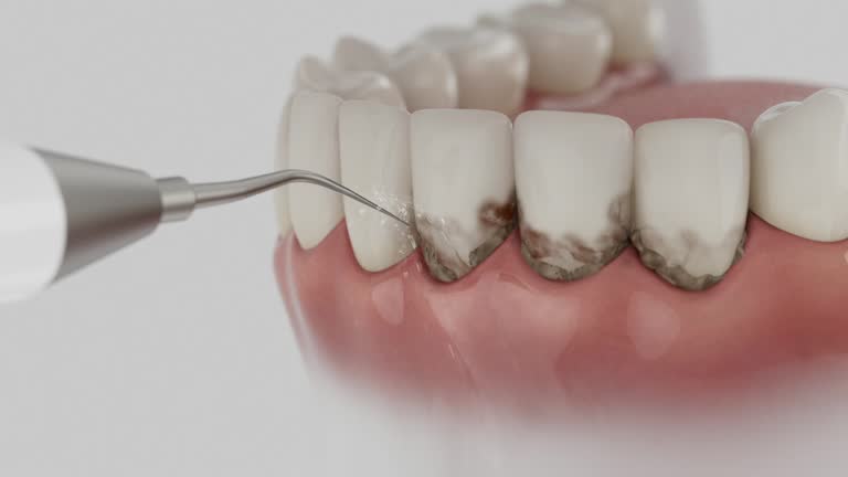 Trusted Dental Implants service in Mount Juliet, TN - Dentist Open Now